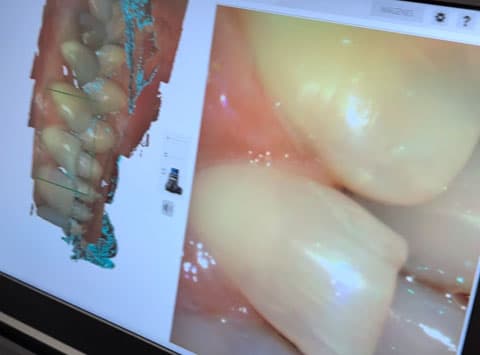 Aparatología de Clínica dental en Pontevedra