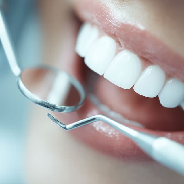 Sonrisa perfecta con tratamientos de estética dental en Pontevedra